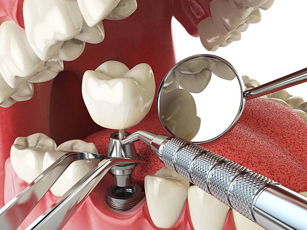 Best Emergency Broken Tooth Repair in Brooklyn, WI